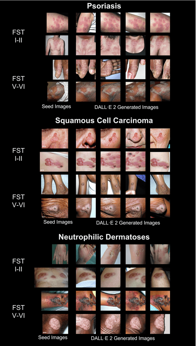 Figure 3 for Improving dermatology classifiers across populations using images generated by large diffusion models