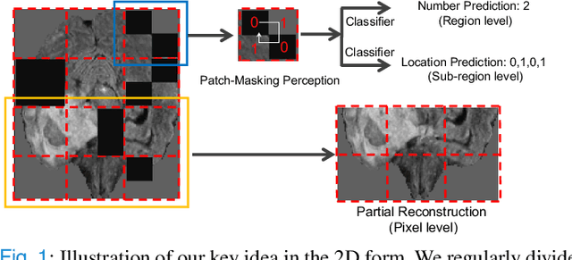 Figure 1 for HybridMIM: A Hybrid Masked Image Modeling Framework for 3D Medical Image Segmentation