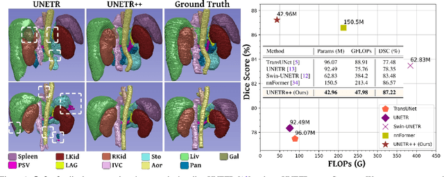 Figure 1 for UNETR++: Delving into Efficient and Accurate 3D Medical Image Segmentation