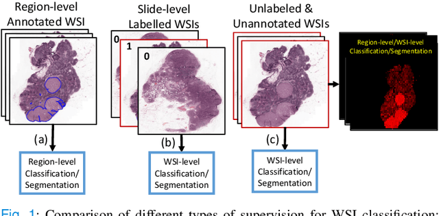 Figure 1 for Unsupervised Mutual Transformer Learning for Multi-Gigapixel Whole Slide Image Classification