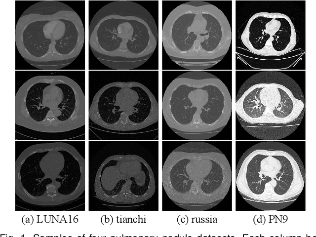 Figure 1 for SGDA: Towards 3D Universal Pulmonary Nodule Detection via Slice Grouped Domain Attention
