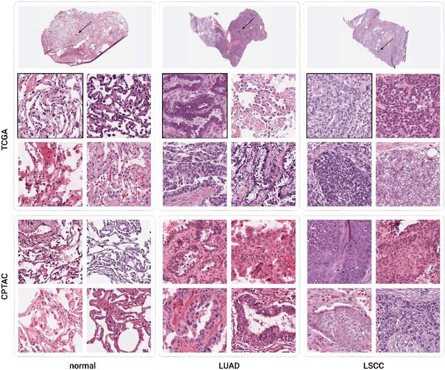 Figure 3 for The NCI Imaging Data Commons as a platform for reproducible research in computational pathology