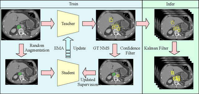 Figure 2 for An End-to-End Framework For Universal Lesion Detection With Missing Annotations