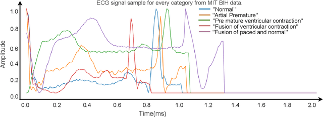 Figure 3 for HARDC : A novel ECG-based heartbeat classification method to detect arrhythmia using hierarchical attention based dual structured RNN with dilated CNN