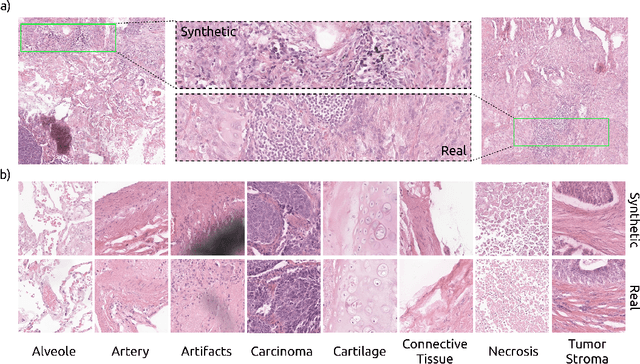 Figure 1 for DiffInfinite: Large Mask-Image Synthesis via Parallel Random Patch Diffusion in Histopathology