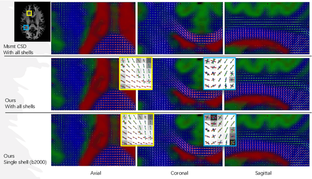 Figure 3 for A Unified Single-stage Learning Model for Estimating Fiber Orientation Distribution Functions on Heterogeneous Multi-shell Diffusion-weighted MRI