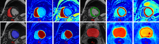 Figure 4 for Self-aware and Cross-sample Prototypical Learning for Semi-supervised Medical Image Segmentation
