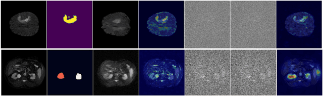 Figure 1 for Conditional Diffusion Models for Weakly Supervised Medical Image Segmentation