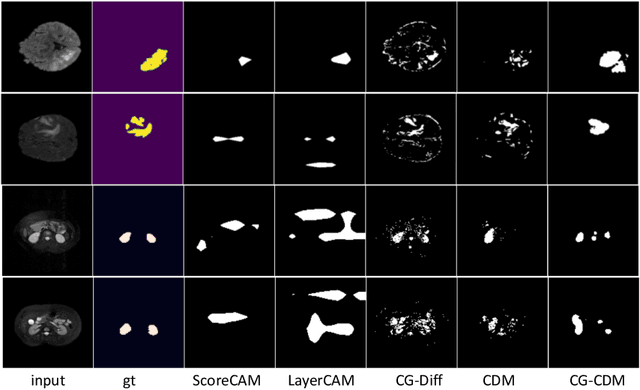 Figure 4 for Conditional Diffusion Models for Weakly Supervised Medical Image Segmentation