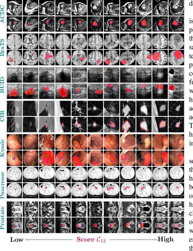 Figure 3 for U-Netmer: U-Net meets Transformer for medical image segmentation