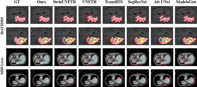 Figure 4 for Diff-UNet: A Diffusion Embedded Network for Volumetric Segmentation
