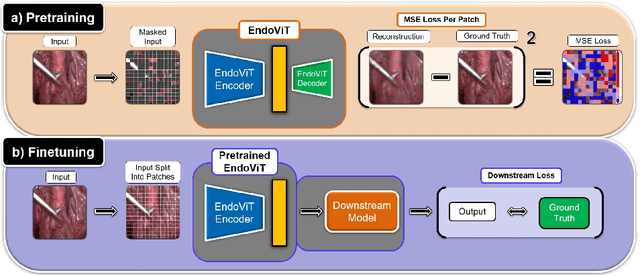 Figure 2 for Whether and When does Endoscopy Domain Pretraining Make Sense?