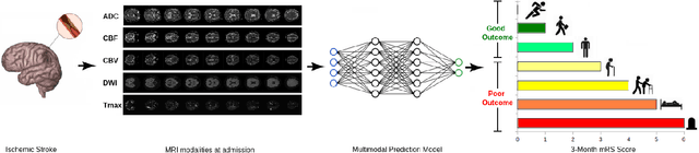 Figure 1 for A Novel Autoencoders-LSTM Model for Stroke Outcome Prediction using Multimodal MRI Data