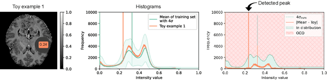 Figure 3 for Histogram- and Diffusion-Based Medical Out-of-Distribution Detection