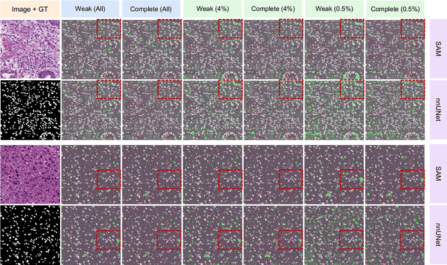Figure 3 for All-in-SAM: from Weak Annotation to Pixel-wise Nuclei Segmentation with Prompt-based Finetuning