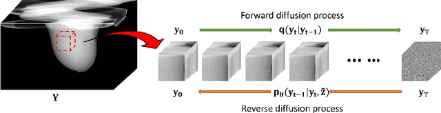 Figure 1 for Sub-volume-based Denoising Diffusion Probabilistic Model for Cone-beam CT Reconstruction from Incomplete Data