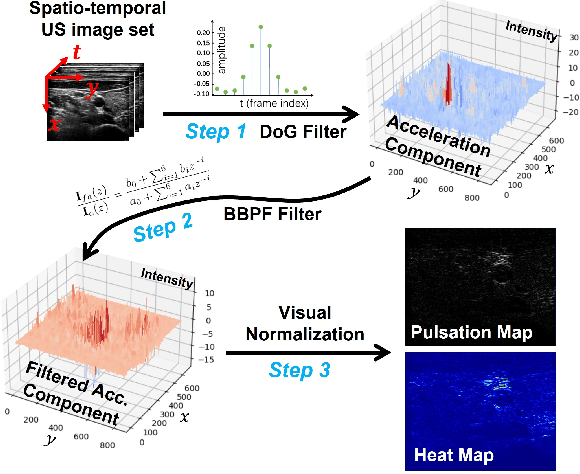 Figure 2 for Motion Magnification in Robotic Sonography: Enabling Pulsation-Aware Artery Segmentation
