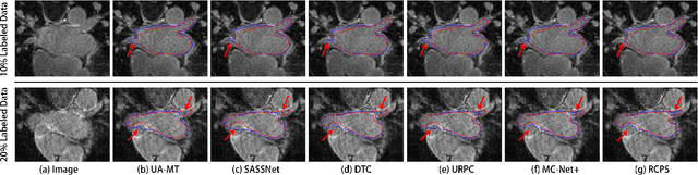 Figure 2 for RCPS: Rectified Contrastive Pseudo Supervision for Semi-Supervised Medical Image Segmentation