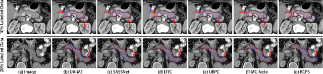 Figure 3 for RCPS: Rectified Contrastive Pseudo Supervision for Semi-Supervised Medical Image Segmentation
