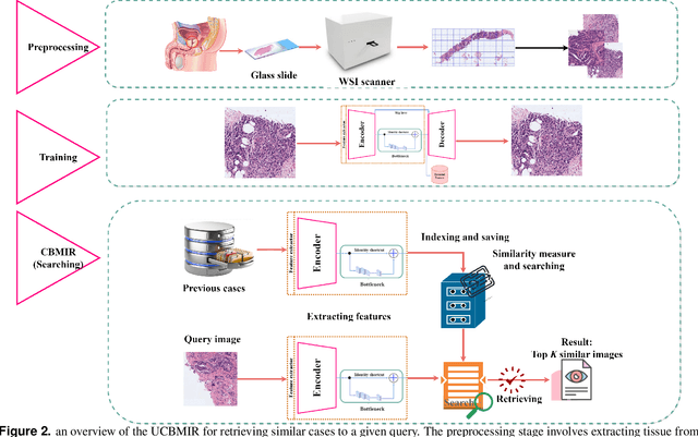 Figure 3 for Towards More Transparent and Accurate Cancer Diagnosis with an Unsupervised CAE Approach