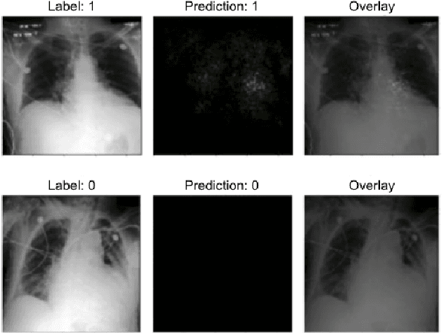 Figure 1 for Predicting Ejection Fraction from Chest X-rays Using Computer Vision for Diagnosing Heart Failure