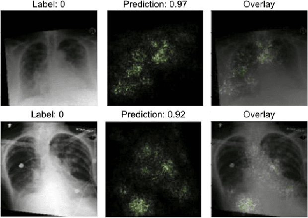 Figure 2 for Predicting Ejection Fraction from Chest X-rays Using Computer Vision for Diagnosing Heart Failure